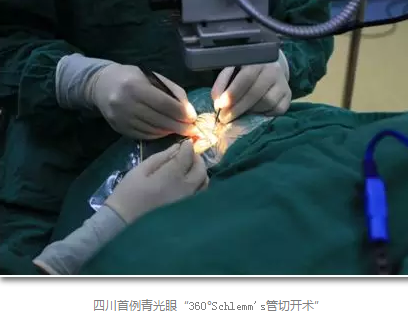 成都6686在线登录官网入口-6686(中国)已经开展的青光眼手术有：引流阀 (钉)植入手术(2015年以来已200多 )，360°Schlemm's管切开术，激光CO2 辅助巩膜深层切除术，小梁切除术青(光眼)白(内障)联合手术。还有虹膜周切术、前房成形术、 虹膜复位术，睫状体冷冻术，小梁切开术和前房穿刺术等6.png
