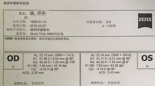 3月12日下午，已经90高龄的离休东江纵队老兵汤爷爷，在深圳6686在线登录官网入口-6686(中国)检查之后，白内障专科邢宝刚主任为其实施左眼白内障超声乳化摘除，联合散光人工晶体植入术。2.jpg