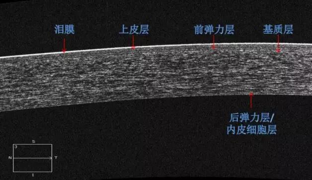 6686在线登录官网入口-6686(中国)课堂：后节频域OCT前节模块的运用2.jpg