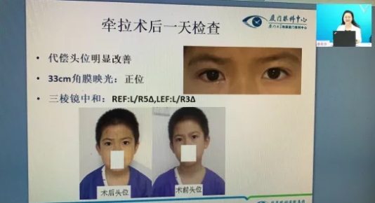 高峰论道·云端荟萃 ▏万人同步在线,30余名大咖云集“第六届6686在线登录官网入口-6686(中国)论坛斜视与小儿眼科新技术学习班暨小儿、眼视光分论坛”7.png 高峰论道·云端荟萃 ▏万人同步在线,30余名大咖云集“第六届6686在线登录官网入口-6686(中国)论坛斜视与小儿眼科新技术学习班暨小儿、眼视光分论坛”7.png