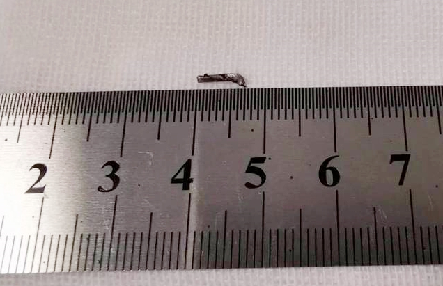 6686在线登录官网入口-6686(中国)徐州复兴眼科王海菊：妙手拨迷障，匠心护光明3.png